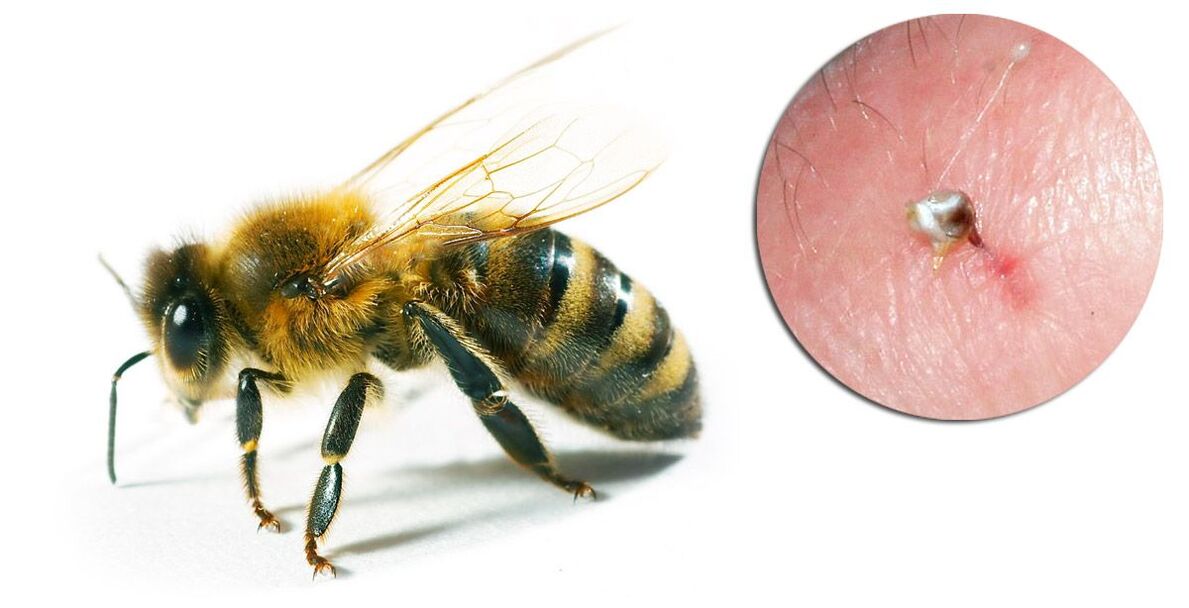 Hondrostrong contiene veleno d'api, che migliora i processi metabolici nei tessuti
