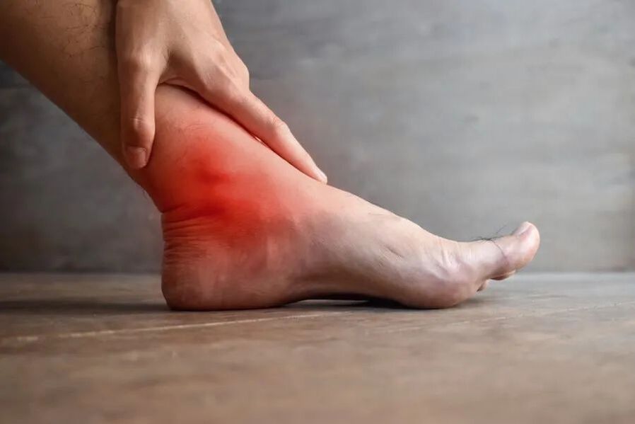 artrosi dell'articolazione della caviglia