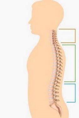 sconfitta da osteocondrosi di diverse parti della colonna vertebrale